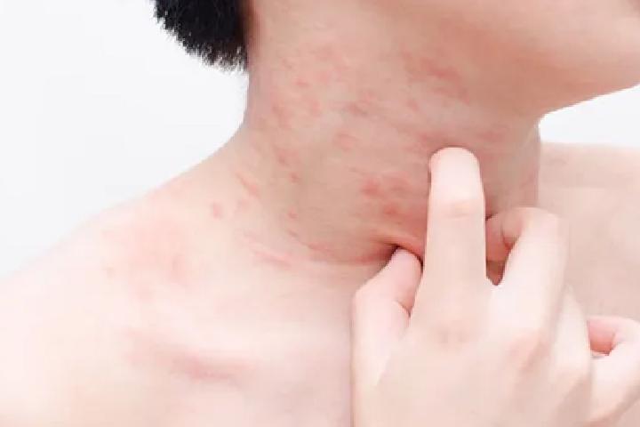 卡波姆的作用与功效是什么